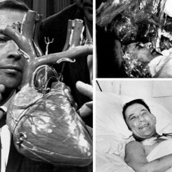 Le professeur Christiaan Barnard (à gauche) après sa réussite de la première transplantation cardiaque (dans la nuit du 2 au 3 décembre 1967) sur le patient Louis Washkansky qui ne survécut que 18 jour.